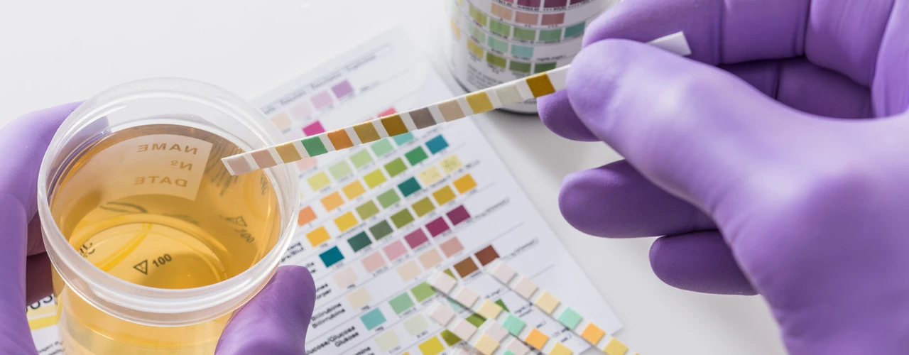 Importance of Drug Testing in the Automotive Industry